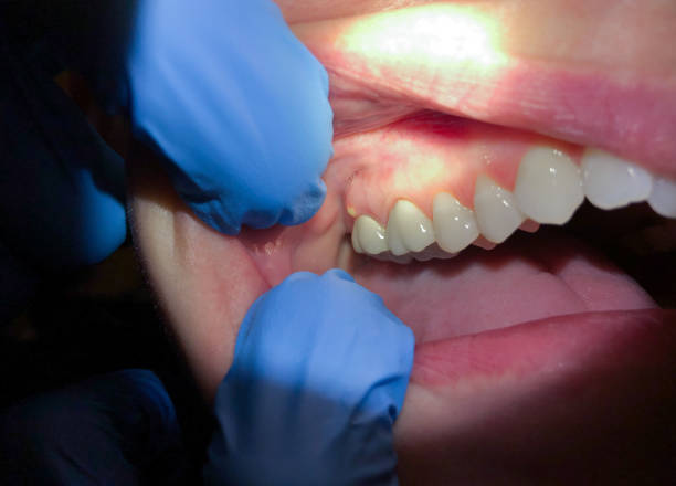Best Cracked Tooth Emergency Dentist  in Clearwater, KS